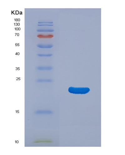 SDS-PAGE analysis of Human AIF1 (Allograft Inflammatory Factor 1) - Recombinant Protein, CAT# BLT-04176P, showing >90% purity under 15% SDS-PAGE (Reduced)Human AIF1 (Allograft Inflammatory Factor 1) - Recombinant Protein