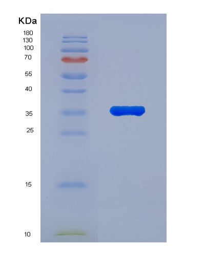 SDS-PAGE analysis of Human VCP (Transitional Endoplasmic Reticulum Atpase) - Recombinant Protein, CATHuman VCP (Transitional Endoplasmic Reticulum Atpase) - Recombinant Protein