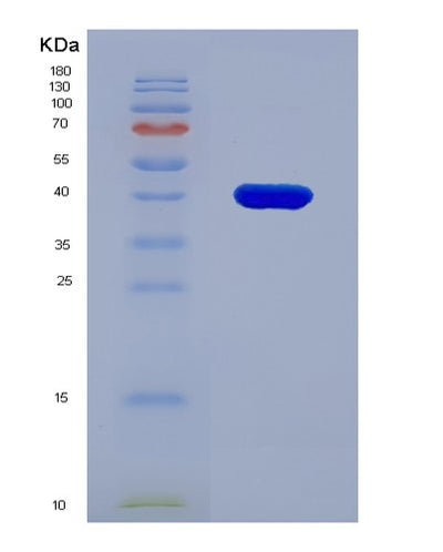 SDS-PAGE analysis of Human MFAP3 (Microfibril-Associated Glycoprotein 3) - Recombinant Protein, CAT# BLT-01841P, showing >90% purity under 15% SDS-PAGE (Reduced)Human MFAP3 (Microfibril-Associated Glycoprotein 3) - Recombinant Protein
