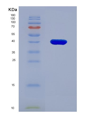 SDS-PAGE analysis of Human MFAP3 (Microfibril-Associated Glycoprotein 3) - Recombinant Protein, CATHuman MFAP3 (Microfibril-Associated Glycoprotein 3) - Recombinant Protein