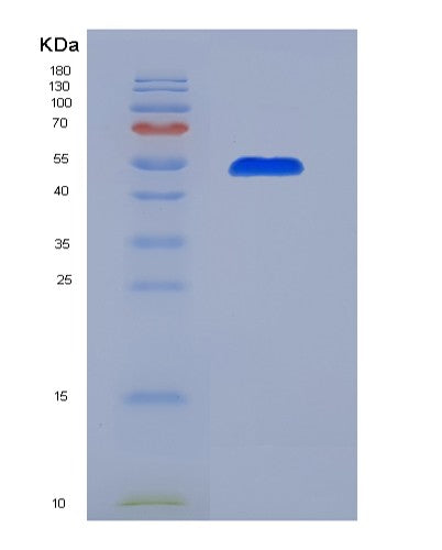 SDS-PAGE analysis of Human F9 (Coagulation Factor Ix) - Recombinant Protein, CATHuman F9 (Coagulation Factor Ix) - Recombinant Protein
