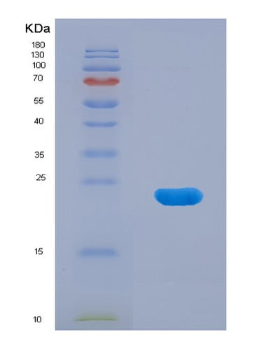 SDS-PAGE analysis of Mouse Afm (Afamin) - Recombinant Protein, CAT# BLT-07670P, showing >90% purity under 15% SDS-PAGE (Reduced)Mouse Afm (Afamin) - Recombinant Protein