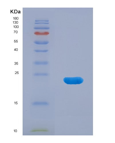 SDS-PAGE analysis of Mouse Afm (Afamin) - Recombinant Protein, CATMouse Afm (Afamin) - Recombinant Protein