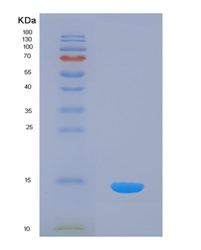 SDS-PAGE analysis of Human INHBC (Inhibin Beta C Chain) - Recombinant Protein, CAT# BLT-01568P, showing >85% purity under 15% SDS-PAGE (Reduced)Human INHBC (Inhibin Beta C Chain) - Recombinant Protein