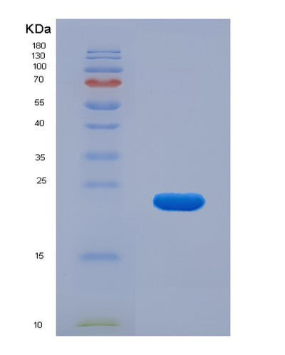 SDS-PAGE analysis of Human MANF (Mesencephalic Astrocyte-Derived Neurotrophic Factor) - Recombinant Protein, CAT# BLT-01780P, showing >85% purity under 15% SDS-PAGE (Reduced)Human MANF (Mesencephalic Astrocyte-Derived Neurotrophic Factor) - Recombinant Protein