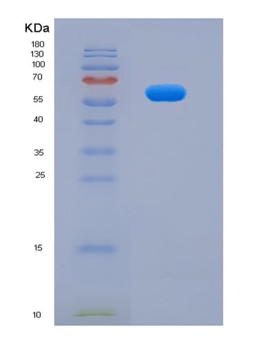 SDS-PAGE analysis of Mouse Pkm (Pyruvate Kinase Pkm) - Recombinant Protein, CAT# BLT-07671P, showing >90% purity under 15% SDS-PAGE (Reduced)Mouse Pkm (Pyruvate Kinase Pkm) - Recombinant Protein