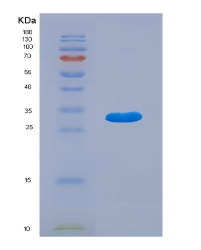 SDS-PAGE analysis of Human ADK (Adenosine Kinase) - Recombinant Protein, CAT# BLT-00071P, showing >95% purity under 15% SDS-PAGE (Reduced)Human ADK (Adenosine Kinase) - Recombinant Protein