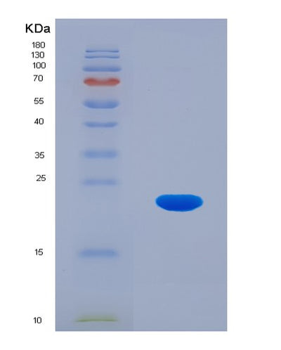 SDS-PAGE analysis of Human CDKN2D (Cyclin-Dependent Kinase 4 Inhibitor D) - Recombinant Protein, CAT# BLT-04385P, showing >95% purity under 15% SDS-PAGE (Reduced)Human CDKN2D (Cyclin-Dependent Kinase 4 Inhibitor D) - Recombinant Protein
