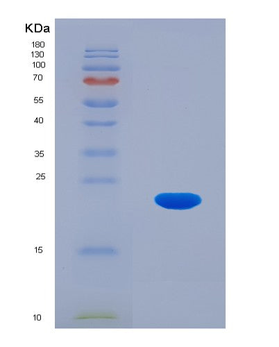 SDS-PAGE analysis of Human CDKN2D (Cyclin-Dependent Kinase 4 Inhibitor D) - Recombinant Protein, CATHuman CDKN2D (Cyclin-Dependent Kinase 4 Inhibitor D) - Recombinant Protein