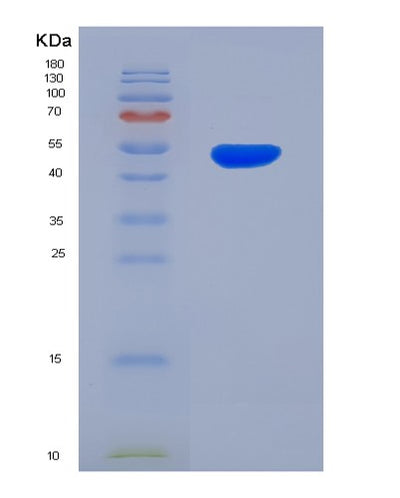 SDS-PAGE analysis of Human CDH11 (Cadherin-11) - Recombinant Protein, CAT# BLT-00535P, showing >95% purity under 15% SDS-PAGE (Reduced)Human CDH11 (Cadherin-11) - Recombinant Protein