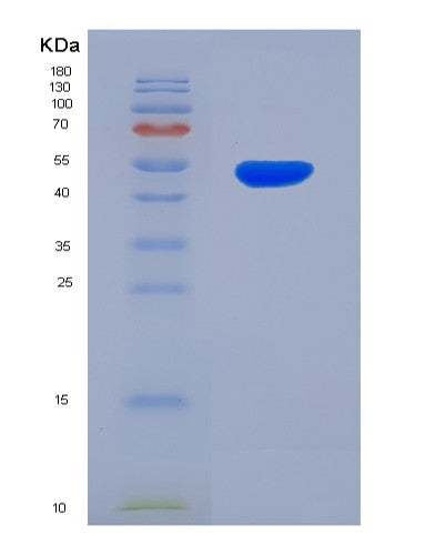 SDS-PAGE analysis of Human CDH11 (Cadherin-11) - Recombinant Protein, CATHuman CDH11 (Cadherin-11) - Recombinant Protein