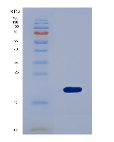 SDS-PAGE analysis of Human SUMO3 (Small Ubiquitin-Related Modifier 3) - Recombinant Protein, CAT# BLT-02934P, showing >85% purity under 15% SDS-PAGE (Reduced)Human SUMO3 (Small Ubiquitin-Related Modifier 3) - Recombinant Protein