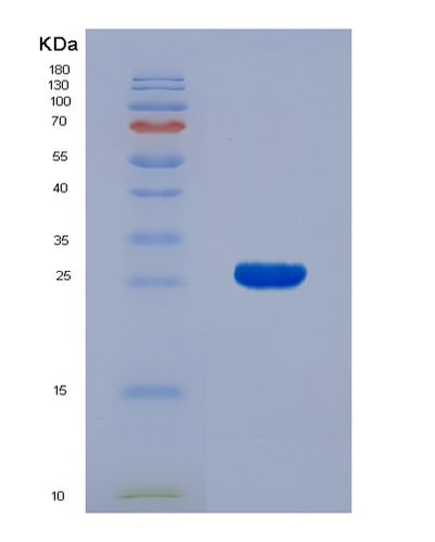 SDS-PAGE analysis of Human BID (Bh3-Interacting Domain Death Agonist) - Recombinant Protein, CAT# BLT-00322P, showing >95% purity under 15% SDS-PAGE (Reduced)Human BID (Bh3-Interacting Domain Death Agonist) - Recombinant Protein