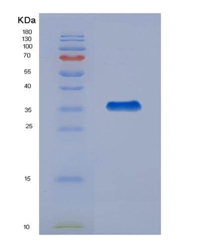 SDS-PAGE analysis of Human LGALS4 (Galectin-4) - Recombinant Protein, CAT# BLT-01146P, showing >90% purity under 15% SDS-PAGE (Reduced)Human LGALS4 (Galectin-4) - Recombinant Protein
