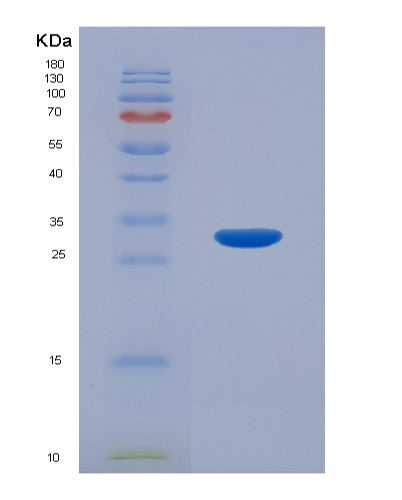 SDS-PAGE analysis of Human BCAR1 (Breast Cancer Anti-Estrogen Resistance Protein 1) - Recombinant Protein, CATHuman BCAR1 (Breast Cancer Anti-Estrogen Resistance Protein 1) - Recombinant Protein