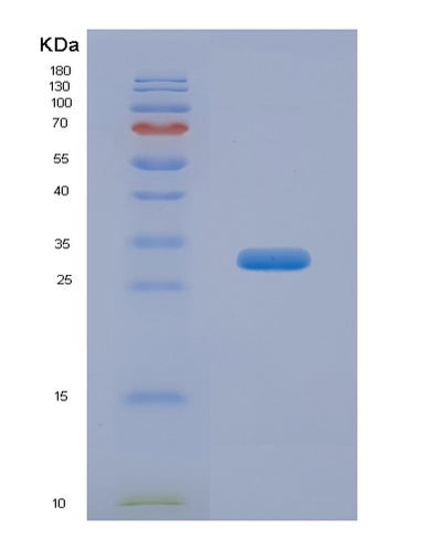 SDS-PAGE analysis of Human ANTXR2 (Anthrax Toxin Receptor 2) - Recombinant Protein, CAT# BLT-00169P, showing >85% purity under 15% SDS-PAGE (Reduced)Human ANTXR2 (Anthrax Toxin Receptor 2) - Recombinant Protein
