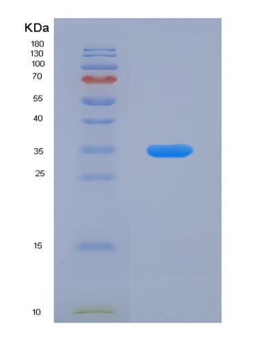 SDS-PAGE analysis of Human TPI1 (Triosephosphate Isomerase) - Recombinant Protein, CAT# BLT-03105P, showing >95% purity under 15% SDS-PAGE (Reduced)Human TPI1 (Triosephosphate Isomerase) - Recombinant Protein
