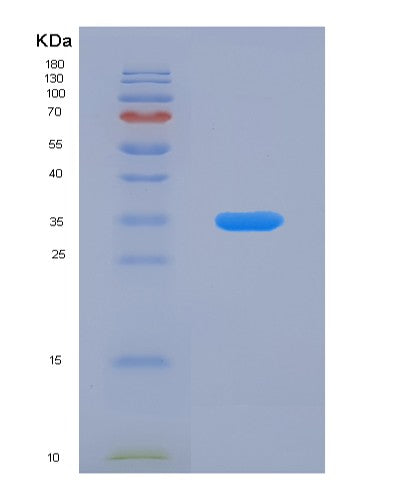 SDS-PAGE analysis of Human TPI1 (Triosephosphate Isomerase) - Recombinant Protein, CATHuman TPI1 (Triosephosphate Isomerase) - Recombinant Protein