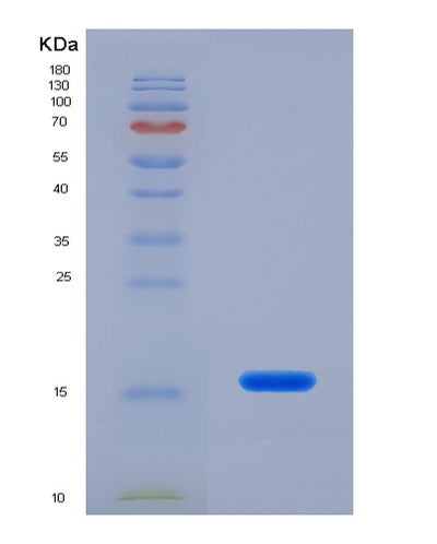 SDS-PAGE analysis of Human GABARAPL2 (Gamma-Aminobutyric Acid Receptor-Associated Protein-Like 2) - Recombinant Protein, CAT# BLT-01132P, showing >90% purity under 15% SDS-PAGE (Reduced)Human GABARAPL2 (Gamma-Aminobutyric Acid Receptor-Associated Protein-Like 2) - Recombinant Protein