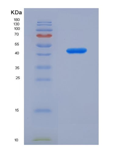 SDS-PAGE analysis of Human DSTN (Destrin) - Recombinant Protein, CAT# BLT-00892P, showing >90% purity under 15% SDS-PAGE (Reduced)Human DSTN (Destrin) - Recombinant Protein