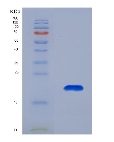 SDS-PAGE analysis of Human GMFB (Glia Maturation Factor Beta) - Recombinant Protein, CATHuman GMFB (Glia Maturation Factor Beta) - Recombinant Protein