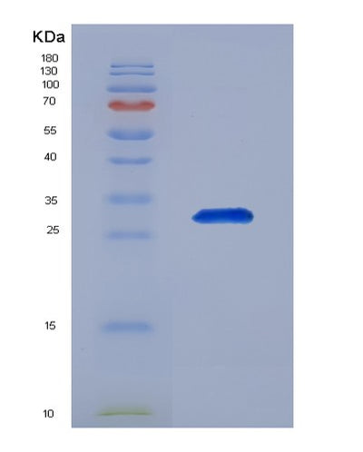 SDS-PAGE analysis of Human ACTR3 (Actin-Related Protein 3) - Recombinant Protein, CAT# BLT-00049P, showing >90% purity under 15% SDS-PAGE (Reduced)Human ACTR3 (Actin-Related Protein 3) - Recombinant Protein