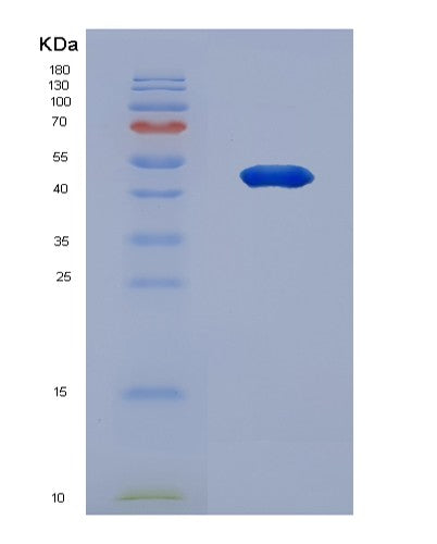 SDS-PAGE analysis of Human MAX (Protein Max) - Recombinant Protein, CATHuman MAX (Protein Max) - Recombinant Protein