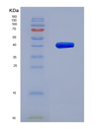 SDS-PAGE analysis of Human OSTN (Osteocrin) - Recombinant Protein, CAT# BLT-02132P, showing >85% purity under 15% SDS-PAGE (Reduced)Human OSTN (Osteocrin) - Recombinant Protein