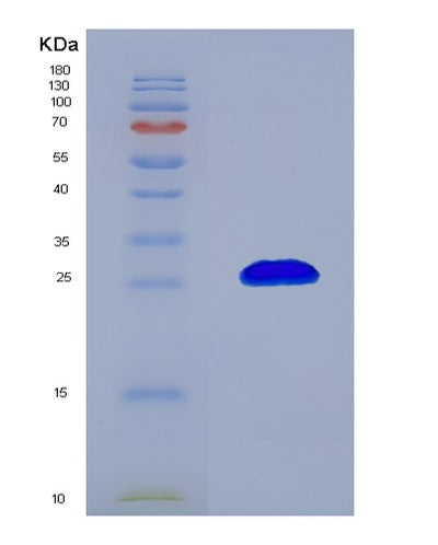 SDS-PAGE analysis of Human RHOA (Transforming Protein Rhoa) - Recombinant Protein, CAT# BLT-02579P, showing >90% purity under 15% SDS-PAGE (Reduced)Human RHOA (Transforming Protein Rhoa) - Recombinant Protein