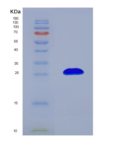 SDS-PAGE analysis of Human RHOA (Transforming Protein Rhoa) - Recombinant Protein, CATHuman RHOA (Transforming Protein Rhoa) - Recombinant Protein
