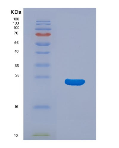 SDS-PAGE analysis of Human NCALD (Neurocalcin-Delta) - Recombinant Protein, CAT# BLT-01974P, showing >85% purity under 15% SDS-PAGE (Reduced)Human NCALD (Neurocalcin-Delta) - Recombinant Protein