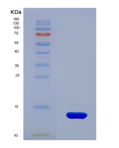 SDS-PAGE analysis of Human B2M (Beta-2-Microglobulin) - Recombinant Protein, CAT# BLT-00273P, showing >95% purity under 15% SDS-PAGE (Reduced)Human B2M (Beta-2-Microglobulin) - Recombinant Protein