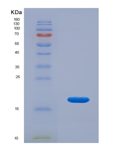 SDS-PAGE analysis of Human SNRPD3 (Small Nuclear Ribonucleoprotein Sm D3) - Recombinant Protein, CAT# BLT-02828P, showing >85% purity under 15% SDS-PAGE (Reduced)Human SNRPD3 (Small Nuclear Ribonucleoprotein Sm D3) - Recombinant Protein