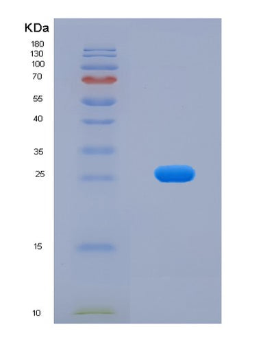 SDS-PAGE analysis of Human ACTA2 (Actin, Aortic Smooth Muscle) - Recombinant Protein, CAT# BLT-00046P, showing >90% purity under 15% SDS-PAGE (Reduced)Human ACTA2 (Actin, Aortic Smooth Muscle) - Recombinant Protein