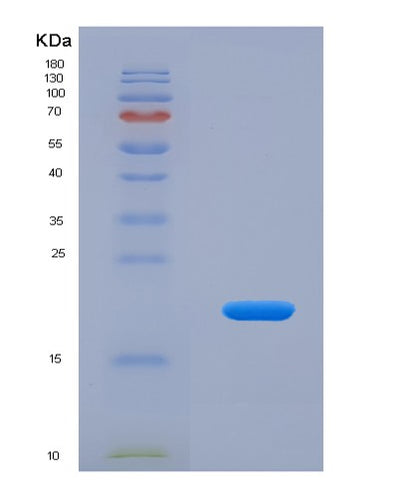 SDS-PAGE analysis of Human VSNL1 (Visinin-Like Protein 1) - Recombinant Protein, CAT# BLT-03292P, showing >85% purity under 15% SDS-PAGE (Reduced)Human VSNL1 (Visinin-Like Protein 1) - Recombinant Protein