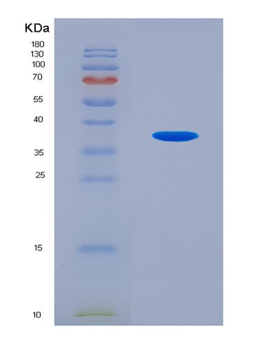 SDS-PAGE analysis of Human CDK13 (Cyclin-Dependent Kinase 13) - Recombinant Protein, CAT# BLT-07673P, showing >90% purity under 15% SDS-PAGE (Reduced)Human CDK13 (Cyclin-Dependent Kinase 13) - Recombinant Protein