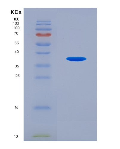 SDS-PAGE analysis of Human CDK13 (Cyclin-Dependent Kinase 13) - Recombinant Protein, CATHuman CDK13 (Cyclin-Dependent Kinase 13) - Recombinant Protein