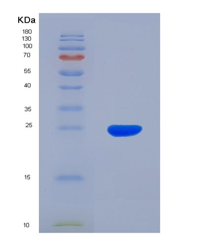 SDS-PAGE analysis of Human RAC1 (Ras-Related C3 Botulinum Toxin Substrate 1) - Recombinant Protein, CATHuman RAC1 (Ras-Related C3 Botulinum Toxin Substrate 1) - Recombinant Protein