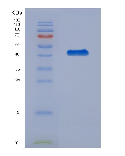 SDS-PAGE analysis of Human PPP3R1 (Calcineurin Subunit B Type 1) - Recombinant Protein, CATHuman PPP3R1 (Calcineurin Subunit B Type 1) - Recombinant Protein
