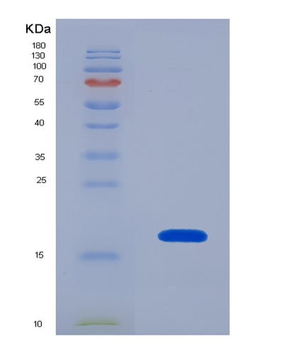 SDS-PAGE analysis of Human YWHAZ (14-3-3 Protein Zeta/Delta) - Recombinant Protein, CAT# BLT-00008P, showing >90% purity under 15% SDS-PAGE (Reduced)Human YWHAZ (14-3-3 Protein Zeta/Delta) - Recombinant Protein