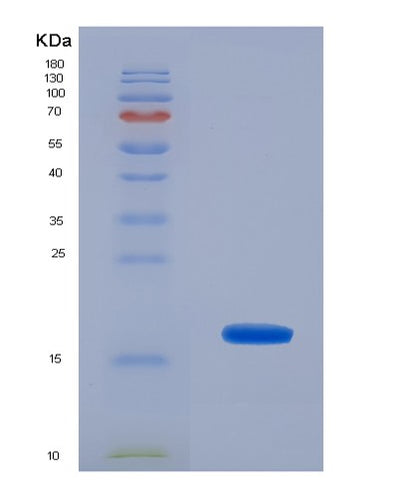 SDS-PAGE analysis of Human UBE2I (Sumo-Conjugating Enzyme Ubc9) - Recombinant Protein, CAT# BLT-03190P, showing >85% purity under 15% SDS-PAGE (Reduced)Human UBE2I (Sumo-Conjugating Enzyme Ubc9) - Recombinant Protein