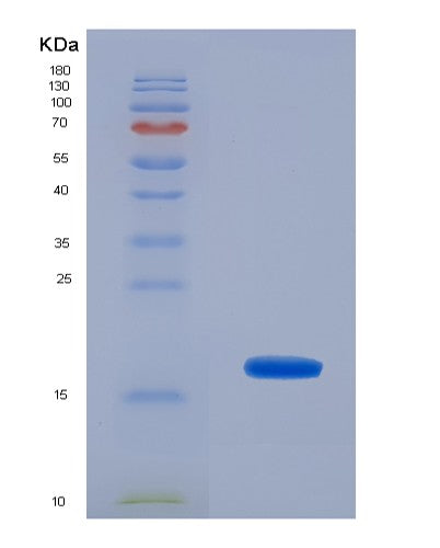 SDS-PAGE analysis of Human UBE2I (Sumo-Conjugating Enzyme Ubc9) - Recombinant Protein, CATHuman UBE2I (Sumo-Conjugating Enzyme Ubc9) - Recombinant Protein