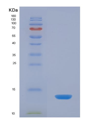 SDS-PAGE analysis of Human SELENOW (Selenoprotein W) - Recombinant Protein, CAT# BLT-02735P, showing >90% purity under 15% SDS-PAGE (Reduced)Human SELENOW (Selenoprotein W) - Recombinant Protein