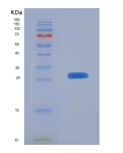 SDS-PAGE analysis of Mouse Lxn (Latexin) - Recombinant Protein, CATMouse Lxn (Latexin) - Recombinant Protein