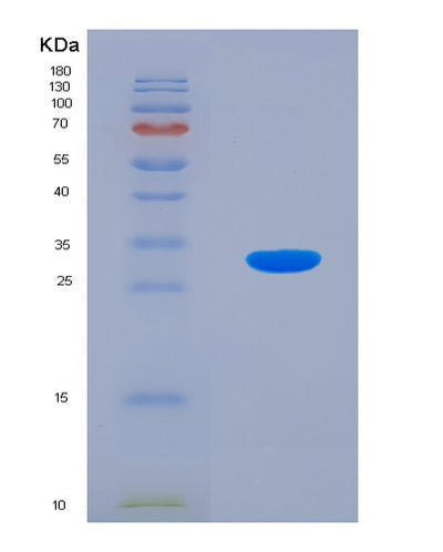 SDS-PAGE analysis of Mouse Txnrd1 (Thioredoxin Reductase 1, Cytoplasmic) - Recombinant Protein, CAT# BLT-07674P, showing >90% purity under 15% SDS-PAGE (Reduced)Mouse Txnrd1 (Thioredoxin Reductase 1, Cytoplasmic) - Recombinant Protein