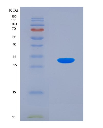 SDS-PAGE analysis of Mouse Txnrd1 (Thioredoxin Reductase 1, Cytoplasmic) - Recombinant Protein, CATMouse Txnrd1 (Thioredoxin Reductase 1, Cytoplasmic) - Recombinant Protein