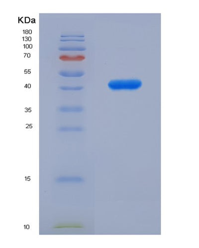 SDS-PAGE analysis of Human ARG2 (Arginase-2, Mitochondrial) - Recombinant Protein, CAT# BLT-00205P, showing >95% purity under 15% SDS-PAGE (Reduced)Human ARG2 (Arginase-2, Mitochondrial) - Recombinant Protein