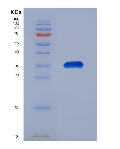 SDS-PAGE analysis of Human GNRHR (Gonadotropin-Releasing Hormone Receptor) - Recombinant Protein, CAT# BLT-07675P, showing >90% purity under 15% SDS-PAGE (Reduced)Human GNRHR (Gonadotropin-Releasing Hormone Receptor) - Recombinant Protein