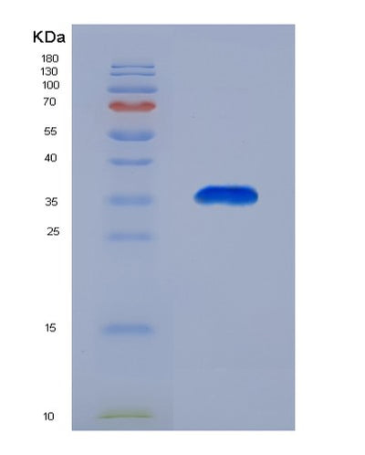 SDS-PAGE analysis of Mouse Gnrhr (Gonadotropin-Releasing Hormone Receptor) - Recombinant Protein, CAT# BLT-07676P, showing >90% purity under 15% SDS-PAGE (Reduced)Mouse Gnrhr (Gonadotropin-Releasing Hormone Receptor) - Recombinant Protein