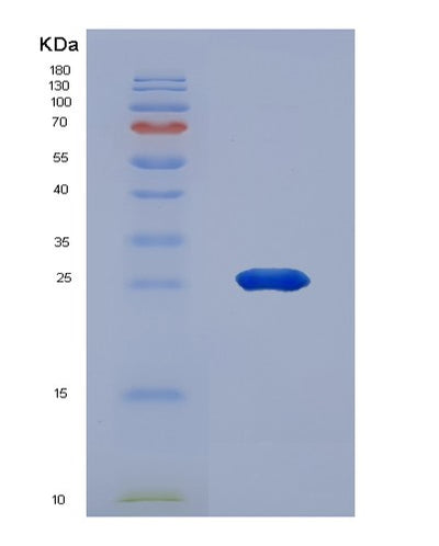 SDS-PAGE analysis of Human APOB (Apolipoprotein B-100) - Recombinant Protein, CAT# BLT-07677P, showing >90% purity under 15% SDS-PAGE (Reduced)Human APOB (Apolipoprotein B-100) - Recombinant Protein